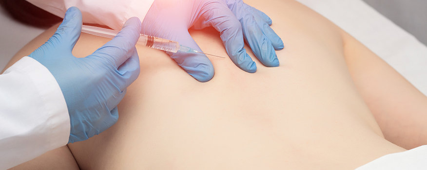 Trigger point injections for muscle pain relief in Orlando